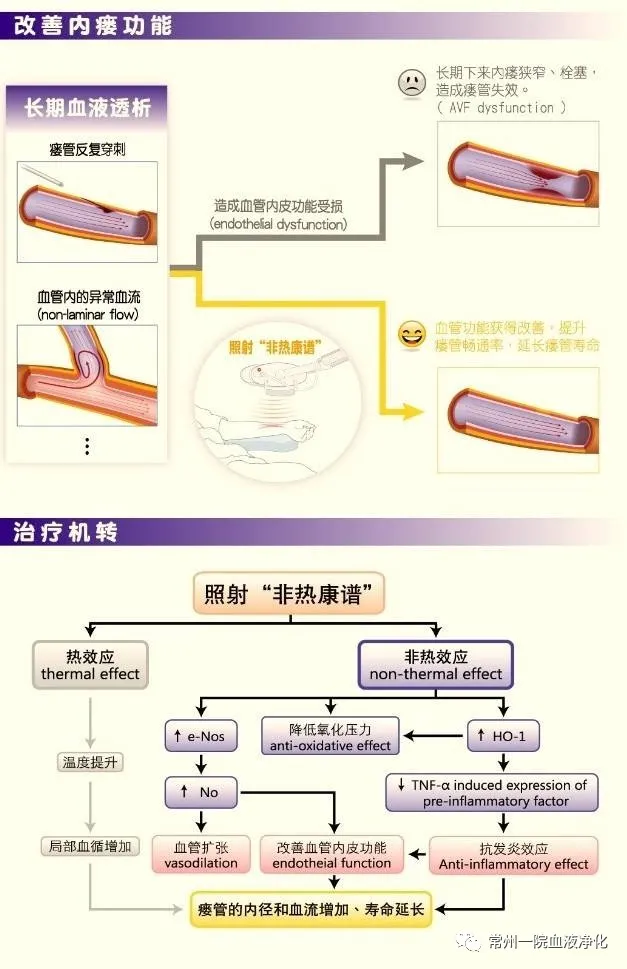 血液透析好帮手-非热康谱血透内瘘治疗仪